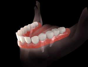 livonia teeth in a day