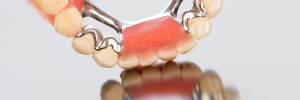 livonia partial dentures