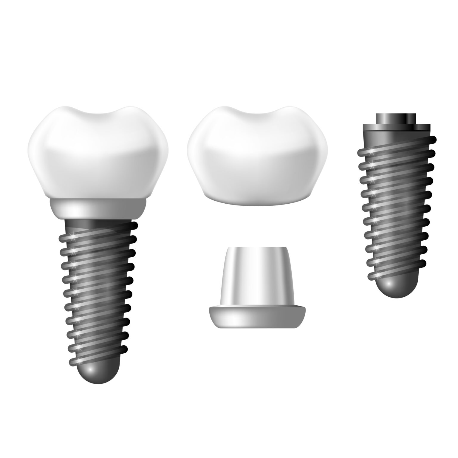 The Three Main Parts Of Your Dental Implant | Livonia, MI