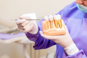 livonia dental implants