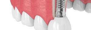 livonia dental technology