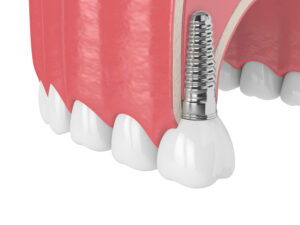 livonia dental technology