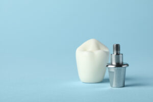 livonia dental implants