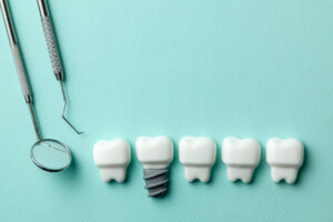 livonia implant dentistry