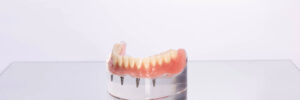 livonia teeth in a day