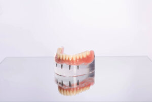 livonia teeth in a day